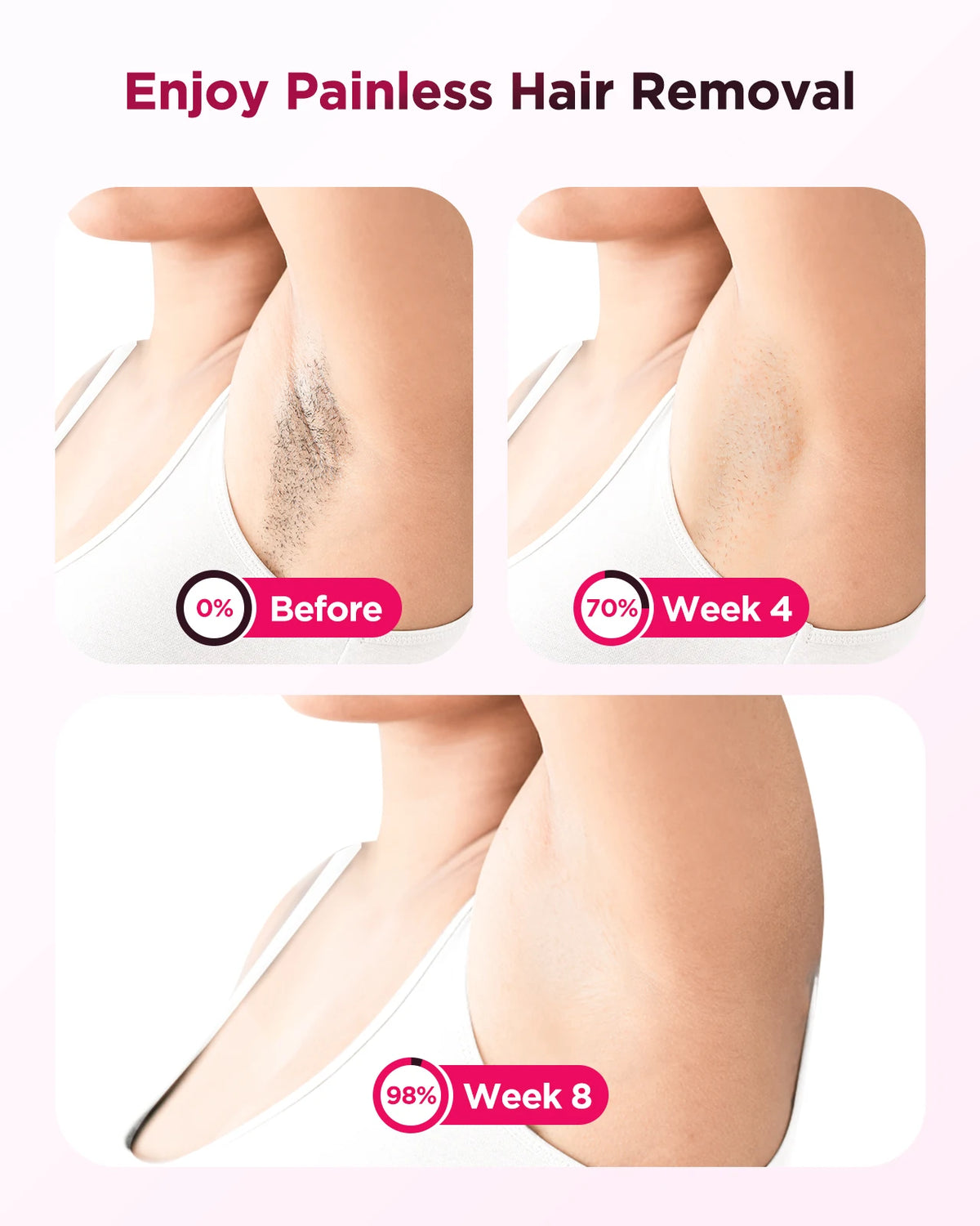 Totmizby IPL Laser Hair Remover Painless Full Body Epilator
